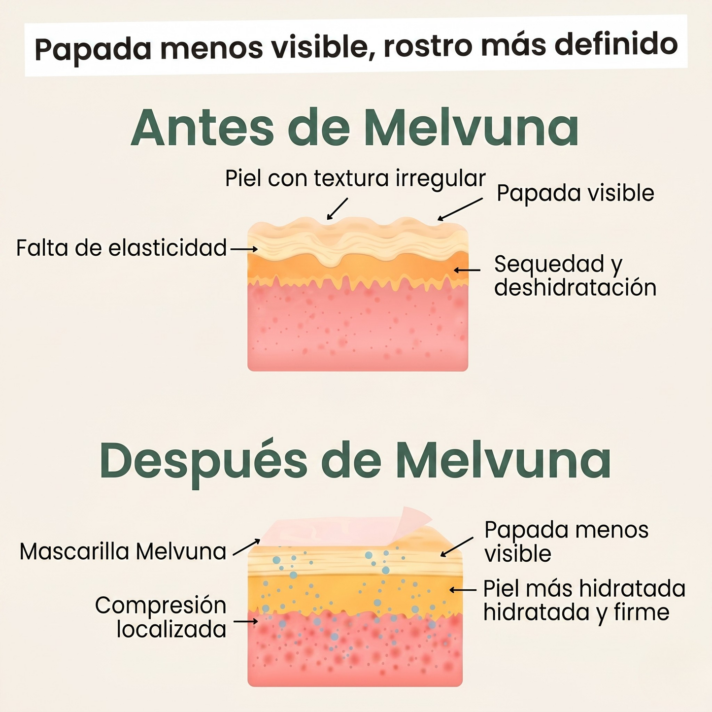 Melvuna™ Mascarilla Lifting para Papada