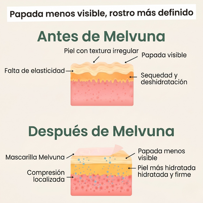 Melvuna™ Mascarilla Lifting para Papada