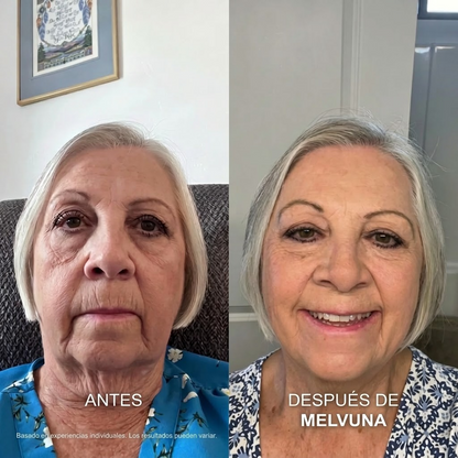 Melvuna™ Mascarilla Lifting para Papada